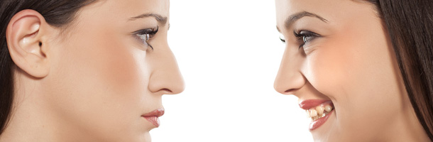 La rhinoplastie