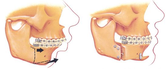 chirurgie maxillo-faciale