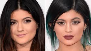 Kylie jenner avant et aprés