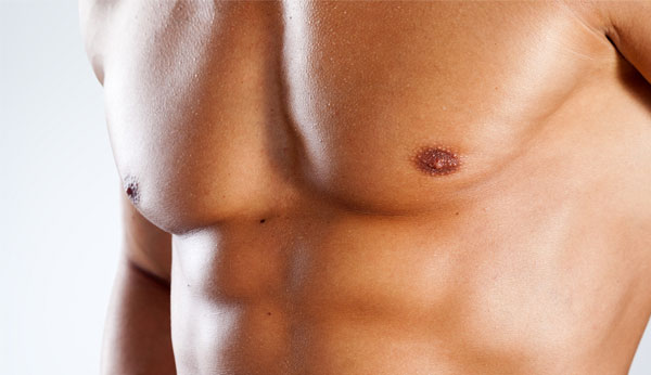 gynecomastie tunisie