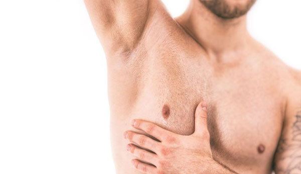 gynecomastie tunisie